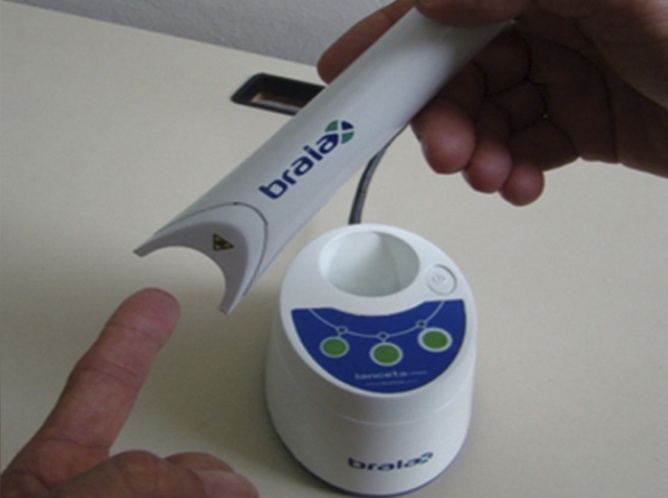 IPN desarrolla una lanceta láser para diabéticos
