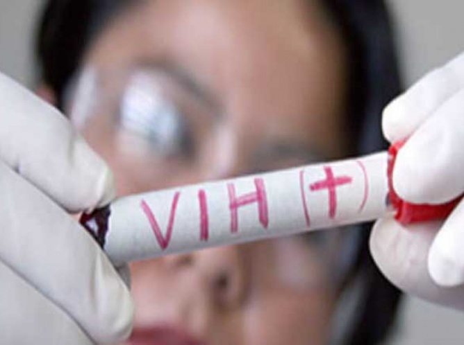 La esperanza de vida de una persona con VIH puede ser de 40 años: Carlos Magis